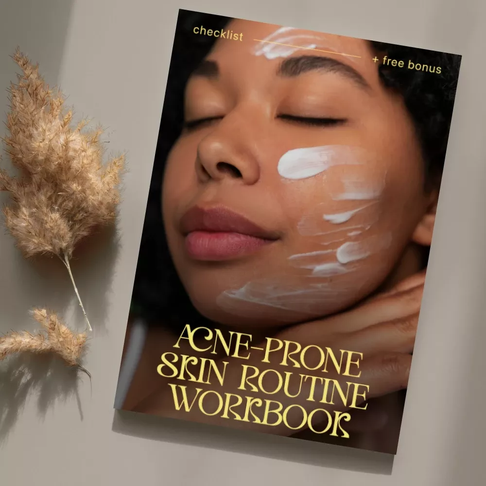 Acne-Prone Skin Routine Workbook – Digital Checklist for Clear Skin Care Routine, Acne Skincare ...
